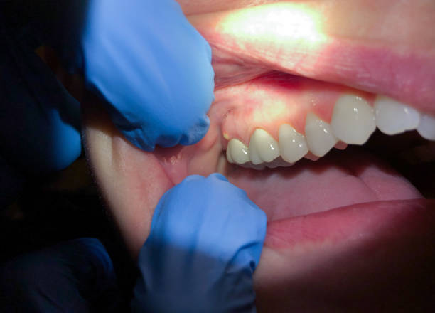 Best Emergency Dentist for Special Needs Patients in Lochmoor Waterway Estates, FL